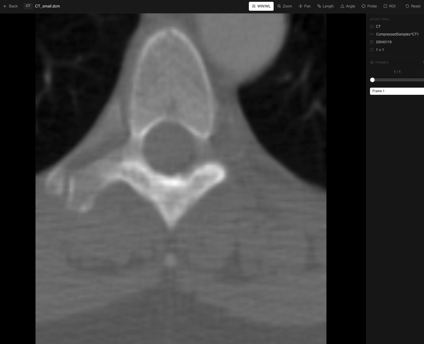 Patien DICOM viewer showing a chest CT scan